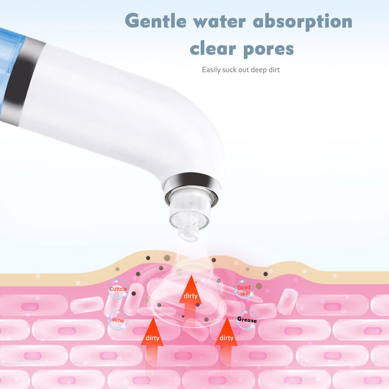 Blackhead Remover Pore Vacuum Cleaner Electric Small Bubble Acne Pimple Removal Facial Cleasing Machine USB Charge Beauty Device-Health Wisdom™