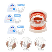 Dental Orthodontic Braces Set 3 Stages Silicone Alignment Trainer Teeth Retainer Bruxism Mouth Guard Kids Teeth Straightener-Health Wisdom™