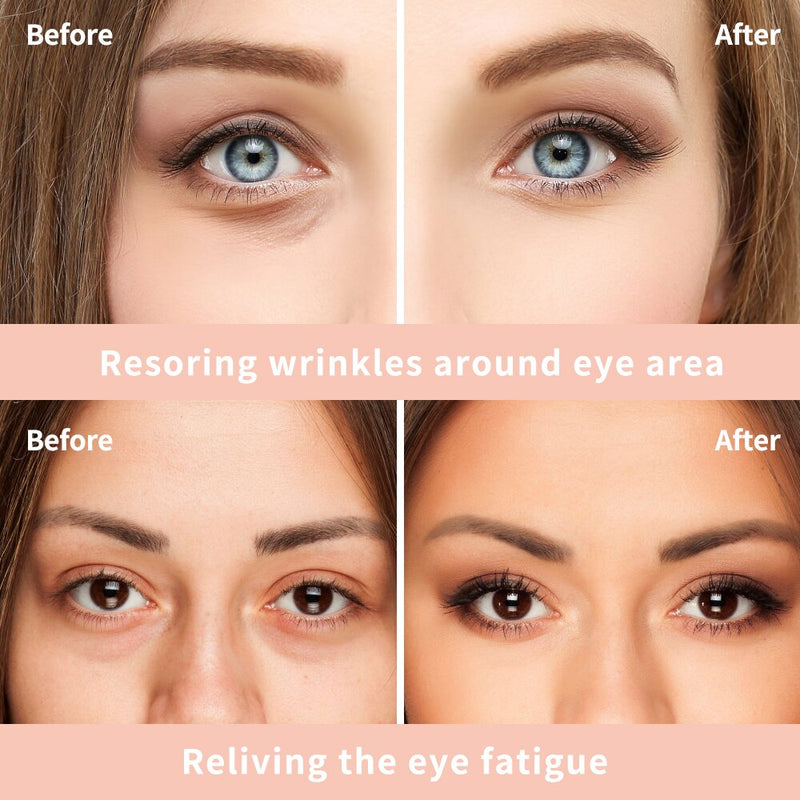 Eye Cream Peptide Collagen Serum Anti-Wrinkle Anti-Age Remove Dark Circles Eye Care Against Puffiness And Bags Hydrate Eye Cream-Health Wisdom™