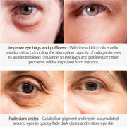 Eye Cream Sakura Serum Anti-Wrinkle Anti-Age Remove Dark Circles Eye Care Against Puffiness And Bags Hydrate Eye Cream 15g-Health Wisdom™
