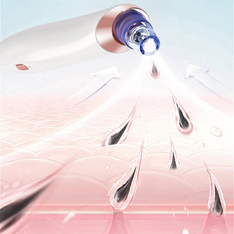 Face Nose Acne Black Dot Pimple Blackhead Remover Electric Blackhead Vacuum Cleaner Pore Blackhead Skin Care Tool Pimple Machine-Health Wisdom™