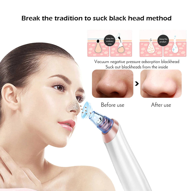 Face Nose Acne Black Dot Pimple Blackhead Remover Electric Blackhead Vacuum Cleaner Pore Blackhead Skin Care Tool Pimple Machine-Health Wisdom™