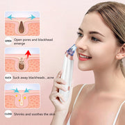 Face Nose Acne Black Dot Pimple Blackhead Remover Electric Blackhead Vacuum Cleaner Pore Blackhead Skin Care Tool Pimple Machine-Health Wisdom™