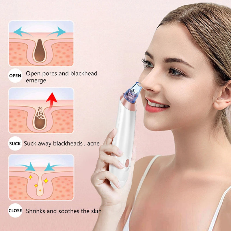 Face Nose Acne Black Dot Pimple Blackhead Remover Electric Blackhead Vacuum Cleaner Pore Blackhead Skin Care Tool Pimple Machine-Health Wisdom™
