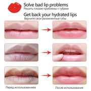 Fruit Vitamin C Moisturizing Skincare Lip Mask Reducing Lip Wrinkles Repair Skin Lip Patches Face Care Masks Recreate Sexy Lips-Health Wisdom™