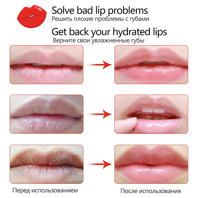 Fruit Vitamin C Moisturizing Skincare Lip Mask Reducing Lip Wrinkles Repair Skin Lip Patches Face Care Masks Recreate Sexy Lips-Health Wisdom™