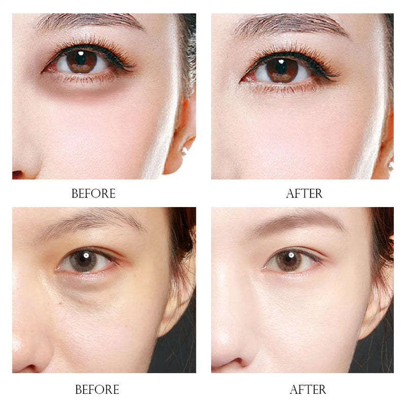Gold Caviar Crystal Collagen Eye Mask Beauty Moisturizing Anti-wrinkle Puffiness Dark Circles Removal Eyes Care Eye Patches-Health Wisdom™