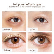 Golden Caviar Eye Cream Moisturizing Improving Eyes Dark Circle Firming Anti-wrinkle Skin Care Products for Eyes Beauty Health-Health Wisdom™