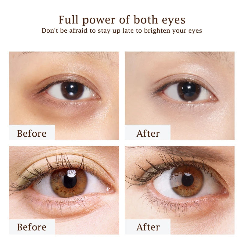 Golden Caviar Eye Cream Moisturizing Improving Eyes Dark Circle Firming Anti-wrinkle Skin Care Products for Eyes Beauty Health-Health Wisdom™