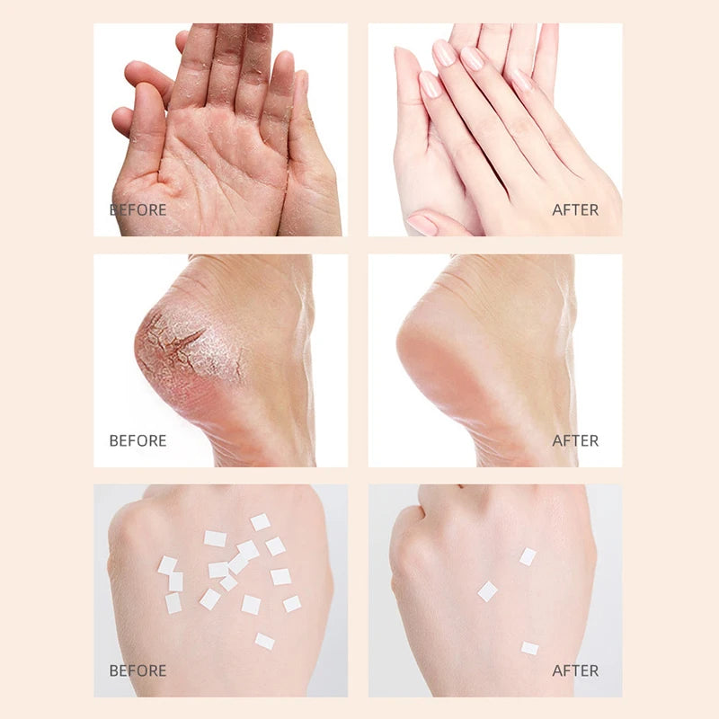 Honey Hand and Foot Moisturizing Cream Anti Wrinkle Cracking Nourishing Repairing Creams Hands Feet Skin Care Products-Health Wisdom™