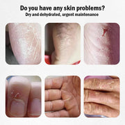 Horse Oil Moisturizing Cream Hand Foot Body Skincare Creams Anti Cracking Repairing Nourishing Hands Feet Skin Care Prodcuts-Health Wisdom™
