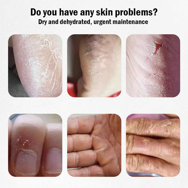Horse Oil Moisturizing Cream Hand Foot Body Skincare Creams Anti Cracking Repairing Nourishing Hands Feet Skin Care Prodcuts-Health Wisdom™