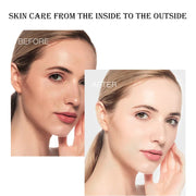 IMAGES 10pcs Hyaluronic Acid Niacinamide Face Masks Moisturizing Shrinking Pores Sheet Mask Beauty Skin Care Facial Mask-Health Wisdom™