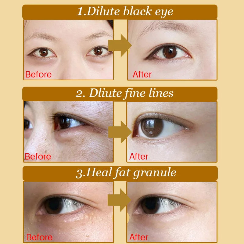 InniCare 20Pcs Crystal Collagen Gold Eye Mask Anti-Aging Dark Circles Acne Beauty Patches For Eye Skin Care Korean Cosmetics-Health Wisdom™