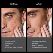 Men's Mineral Mud Skin Care Kit Deep Cleansing Oil Control Moisturizing Facial Cleanser Lotion Face Cream Men Skin Care Set-Health Wisdom™