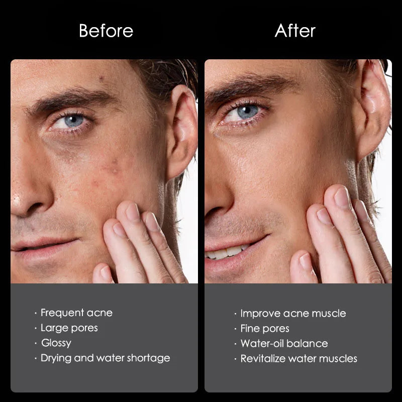 Men's Mineral Mud Skin Care Kit Deep Cleansing Oil Control Moisturizing Facial Cleanser Lotion Face Cream Men Skin Care Set-Health Wisdom™