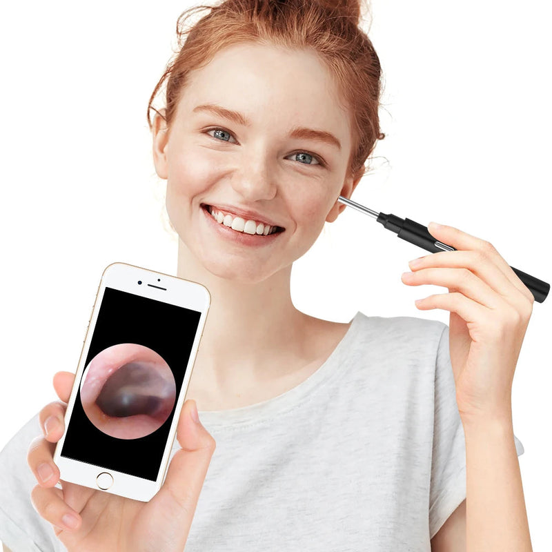 PASTSKY Ear Cleaner Ear Wax Candle Removal Tool WiFi 3.0MP Otoscope Wireless 3.9mm Camera Medical Health Care Oral Inspection-Health Wisdom™