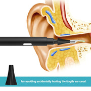 PASTSKY Ear Cleaner Ear Wax Candle Removal Tool WiFi 3.0MP Otoscope Wireless 3.9mm Camera Medical Health Care Oral Inspection-Health Wisdom™