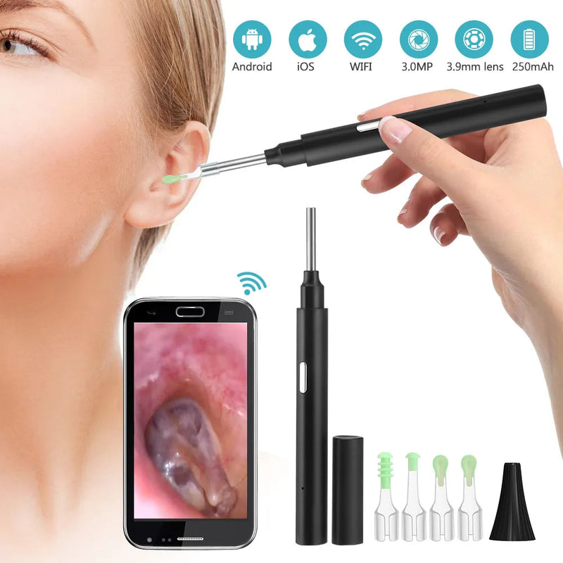 PASTSKY Ear Cleaner Ear Wax Candle Removal Tool WiFi 3.0MP Otoscope Wireless 3.9mm Camera Medical Health Care Oral Inspection-Health Wisdom™