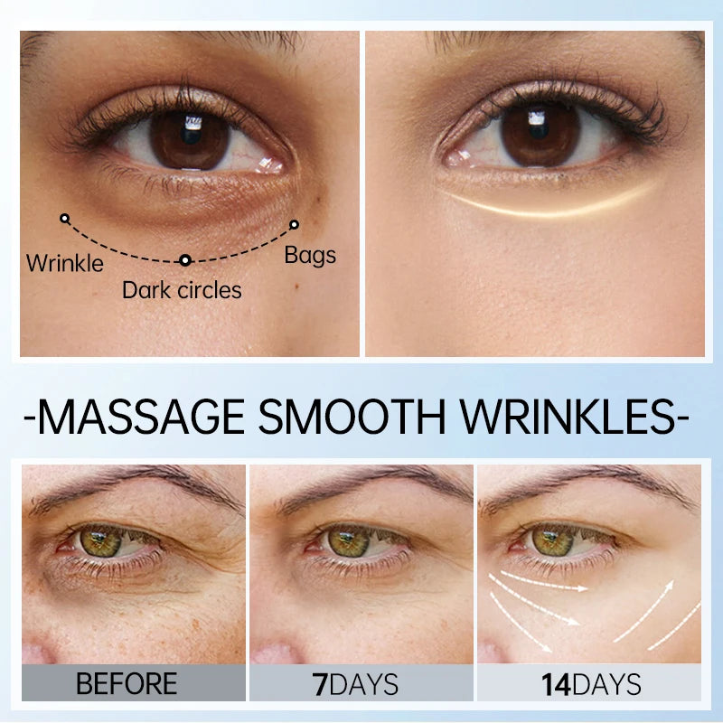 Peptide Eye Cream Dark Circles Removal Eye Bags Firming Moisturizing Anti Wrinkle Anti-aging Eyes Skin Care Products-Health Wisdom™