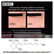 Retinol Anti wrinkle Eye Cream Anti Aging Remove Eye Bags Dark Circles Firming Restore skin Elasticity Skin Eye Care Cream-Health Wisdom™