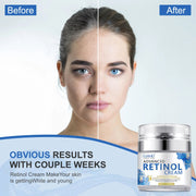 Retinol Face Cream Anti-wrinkle Anti-aging Moisturizing Hyaluronic Acid Vitamin C Facial Cream Skincare Face Whitening Creams-Health Wisdom™