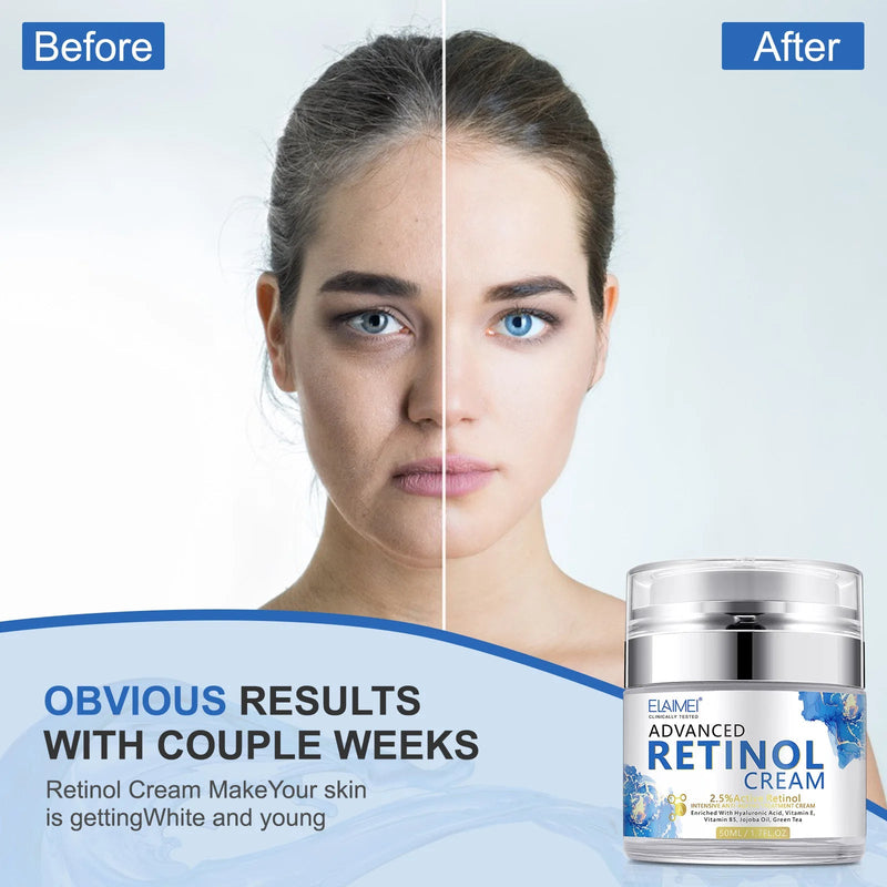 Retinol Face Cream Anti-wrinkle Anti-aging Moisturizing Hyaluronic Acid Vitamin C Facial Cream Skincare Face Whitening Creams-Health Wisdom™