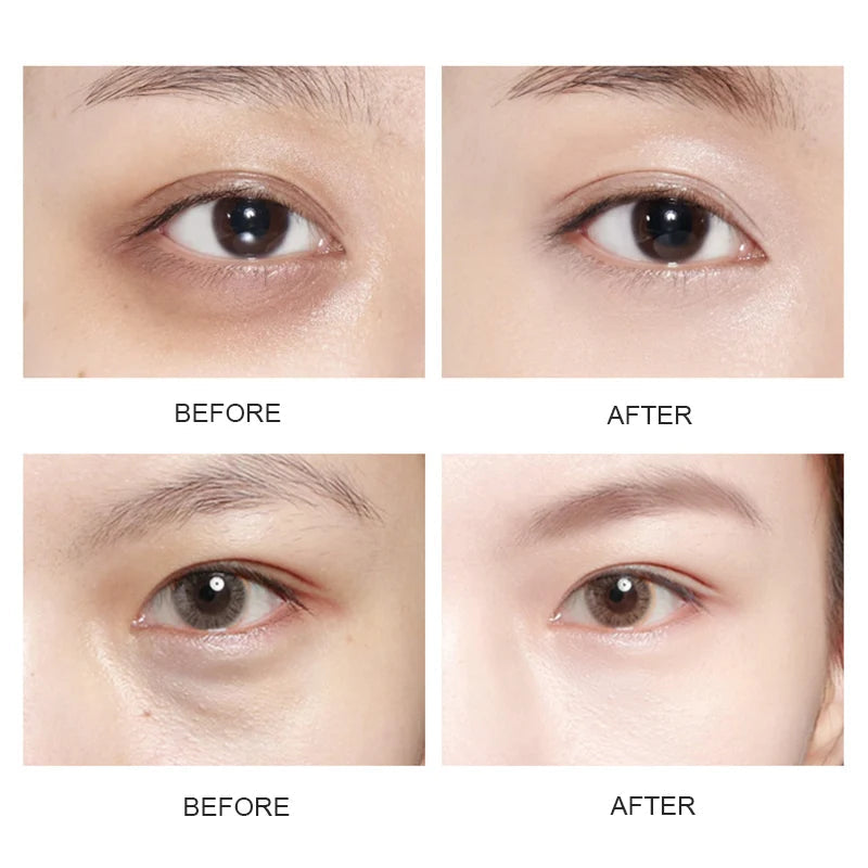 Skin Care Crystal Eye Patches Fade Dark Circles Gold Collagen Eye Mask Keep Moisturizing Firming Skin Anti Aging Wrinkle-Health Wisdom™