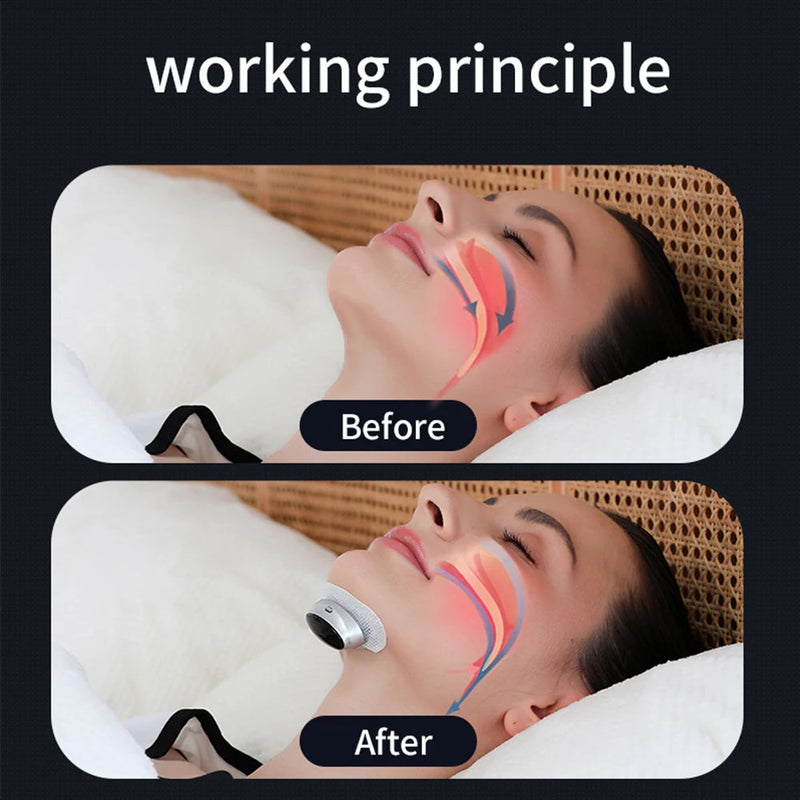 Smart Anti Snoring Device Dual Pulse Muscle Stimulator Stop Snore Relaxation Treatment Health Care Improve Sleeping Effective-Health Wisdom™