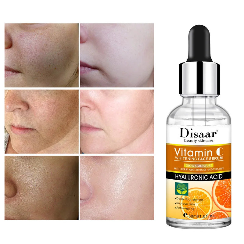 Vitamin C Essence Moisturizing Whitening Cream Anti Wrinkle Eye Cream Care Firming Nourishing Korean Cosmetics Skin Care Set-Health Wisdom™