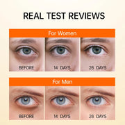 Vitamin C Eye Cream Anti Dark Circles Removal Eye Bags Puffiness Moisturizing Anti-Aging Firming Eyes Skin Care Prdoucts-Health Wisdom™