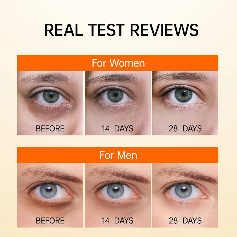 Vitamin C Eye Cream Anti Dark Circles Removal Eye Bags Puffiness Moisturizing Anti-Aging Firming Eyes Skin Care Prdoucts-Health Wisdom™