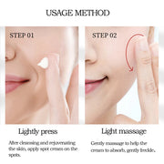 Whitening Freckle Cream Remove Melasma Cream Remove Dark Spots Melanin Melasma Remover Brighten Skin Anti-Aging Skin Lightening-Health Wisdom™