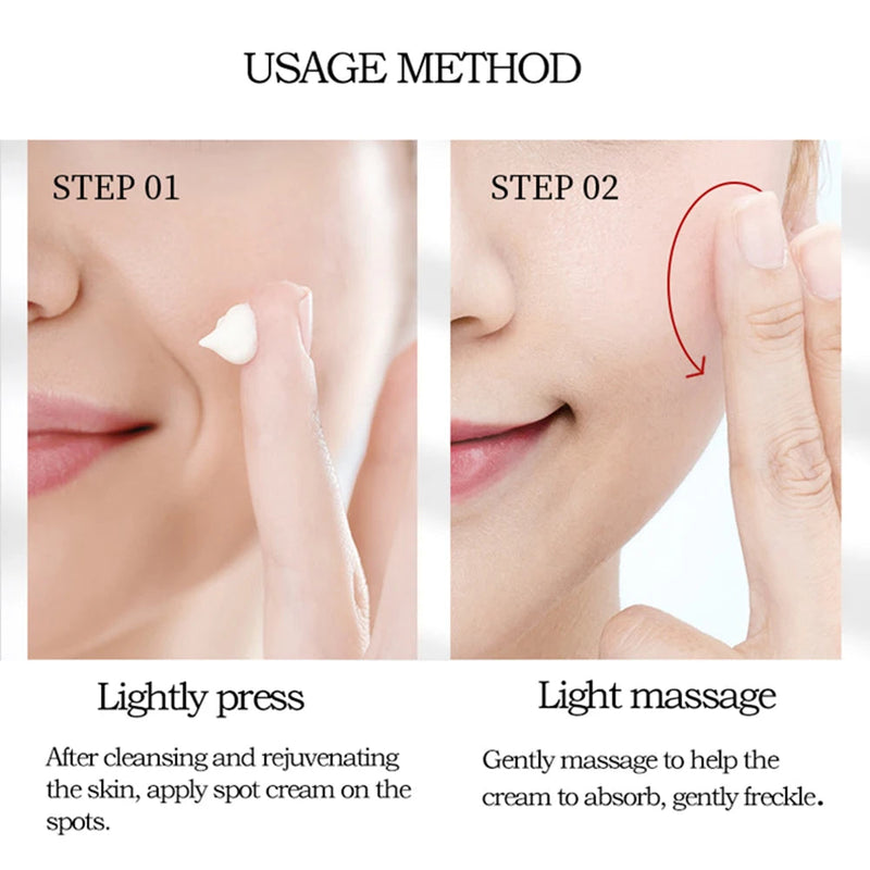 Whitening Freckle Cream Remove Melasma Cream Remove Dark Spots Melanin Melasma Remover Brighten Skin Anti-Aging Skin Lightening-Health Wisdom™